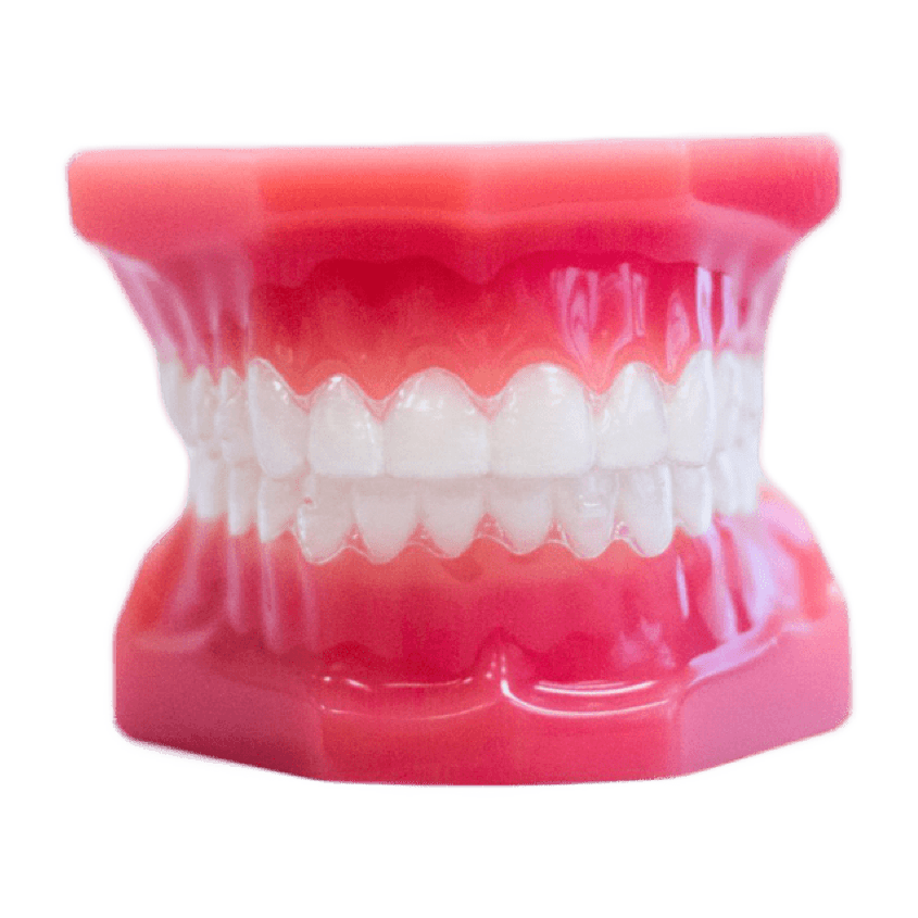 clear aligners