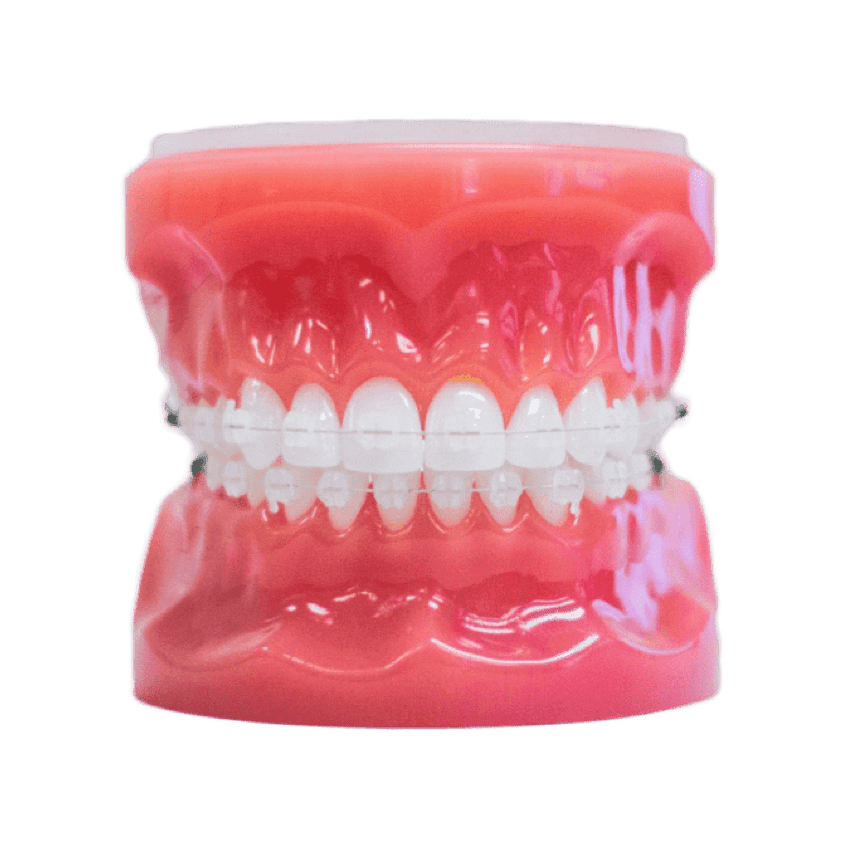 clear braces