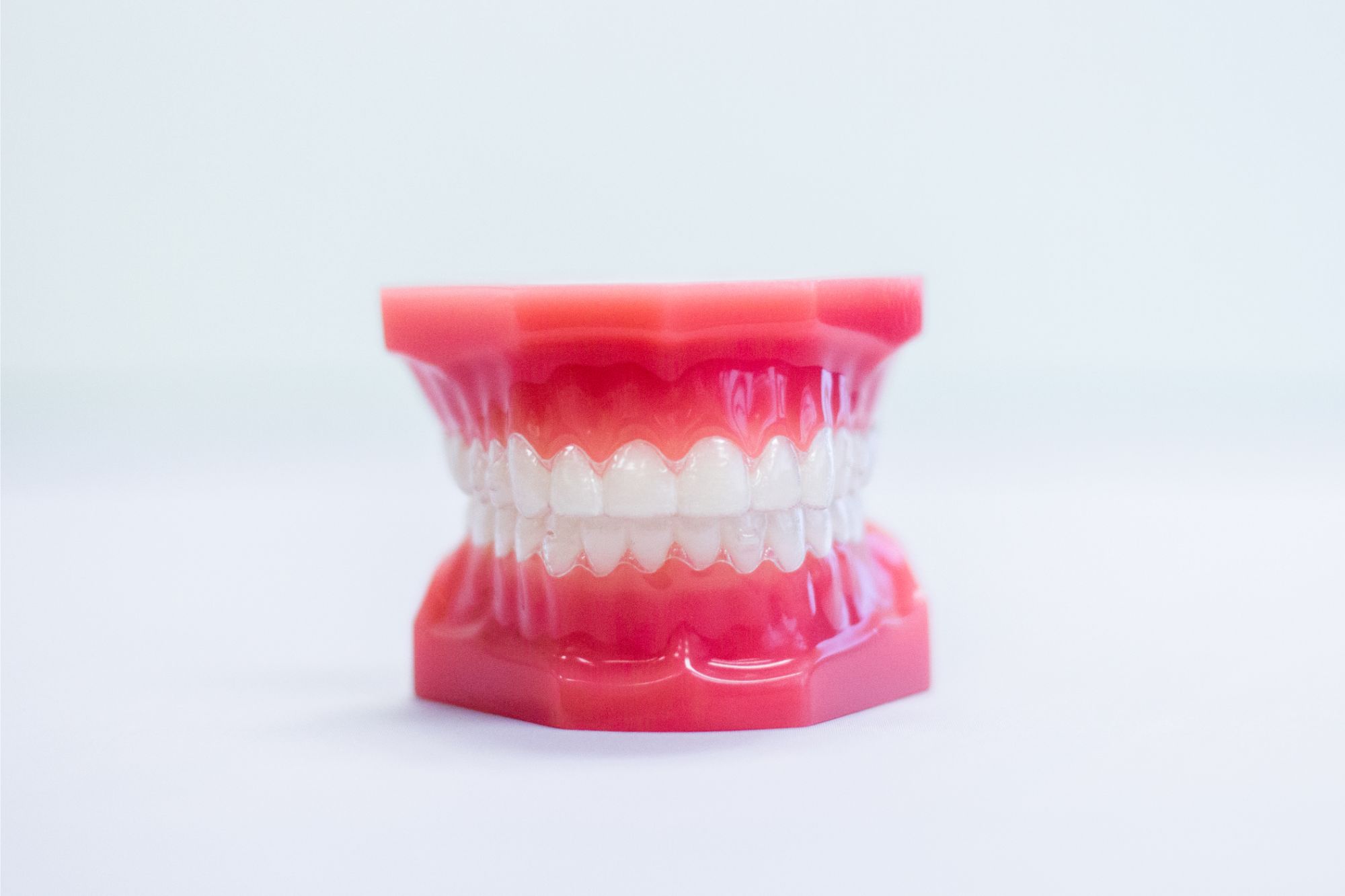 clear aligners on plastic model