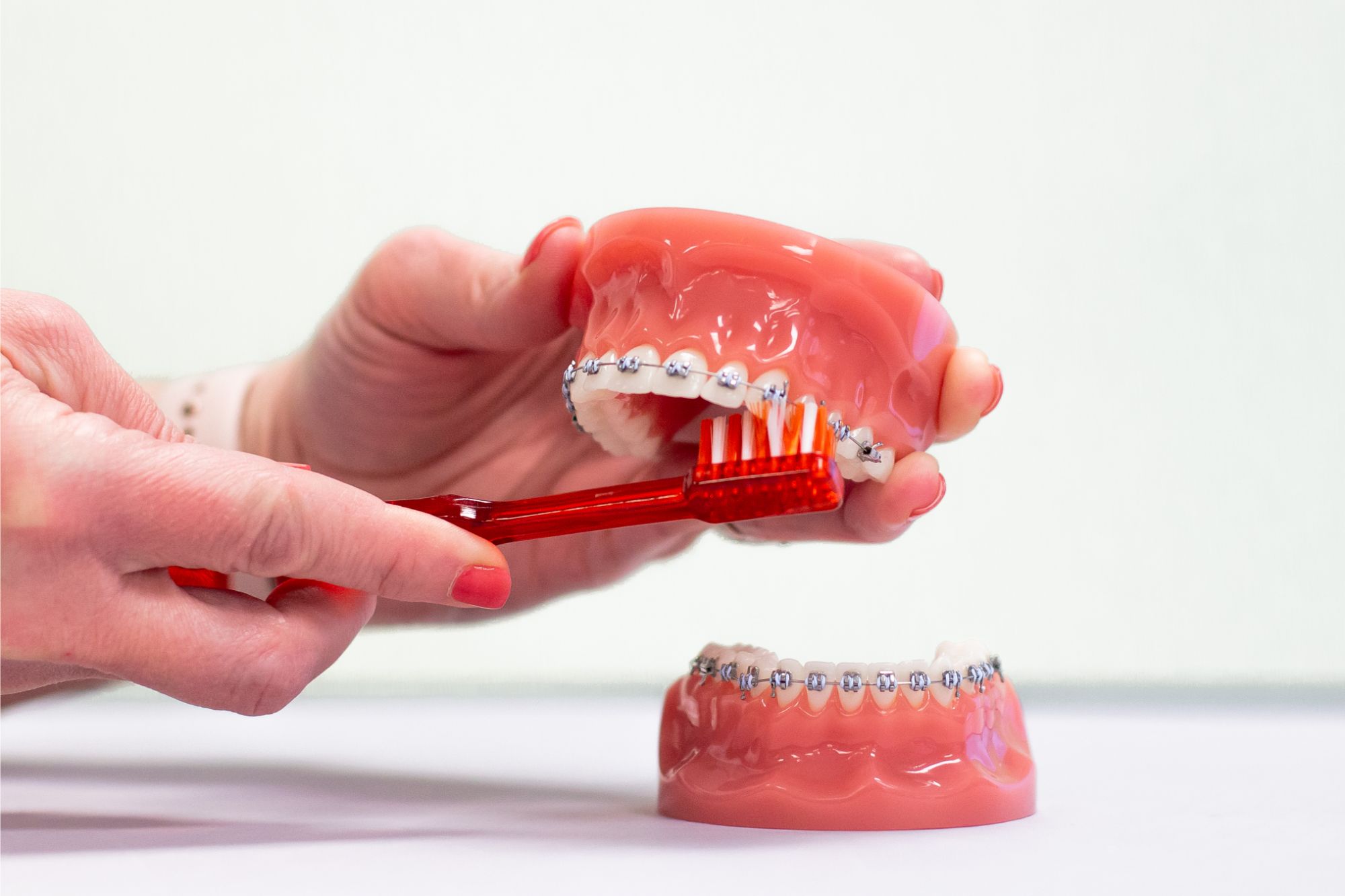 Hands demonstrating brushing technique on dental model with metal braces at Dr. Matt Orthodontics